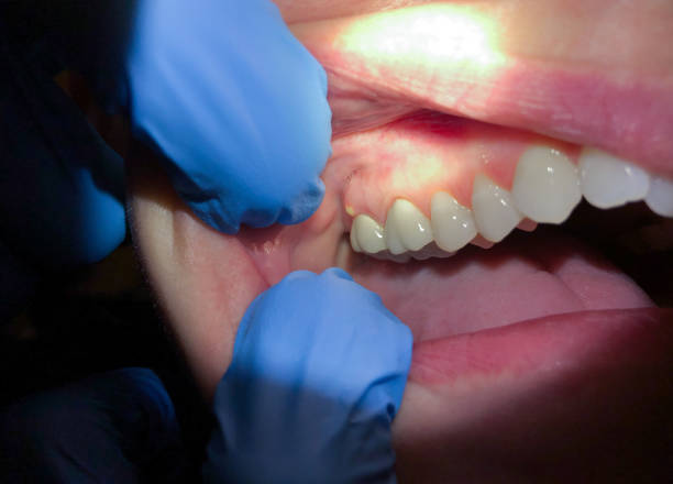 Best Tooth Infection Emergency Dentist  in Monmouth, OR